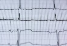 neural technology advancement revealed